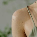 Lyme Disease